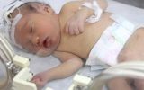 قطع نخاع نوزاد ۵ ماهه گلستانی بر اثر شکستن قلنج! / خود درمانی‌های جاهلانه همچنان قربانی می‌گیرد!